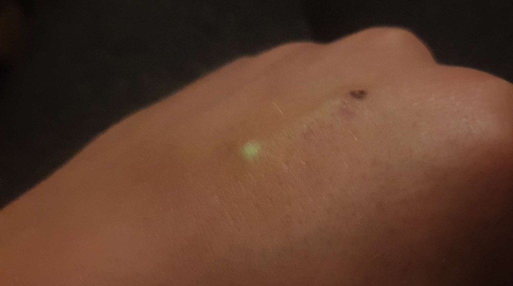 →Glowing Glass Implant